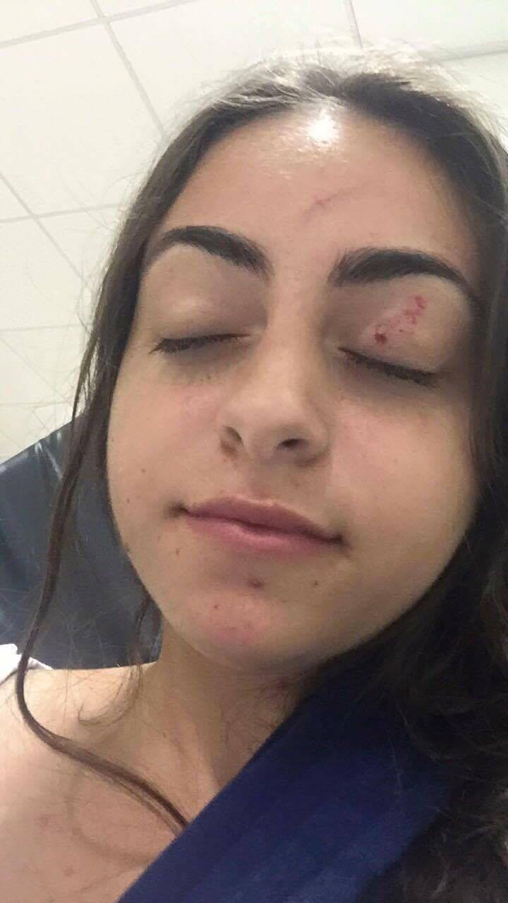 kellyinjured2